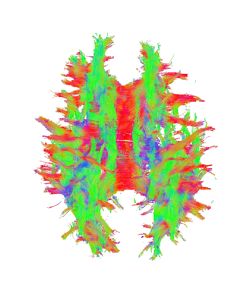 A rotating 3-D map of a brain's magnetic susceptibility