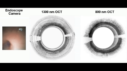 A real-time video captured using MAGIC. Shows an endoscope camera, 1300 mm OCT, and 800 mm OCT.