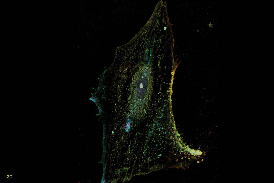 An astrocyte seen on a glass dish