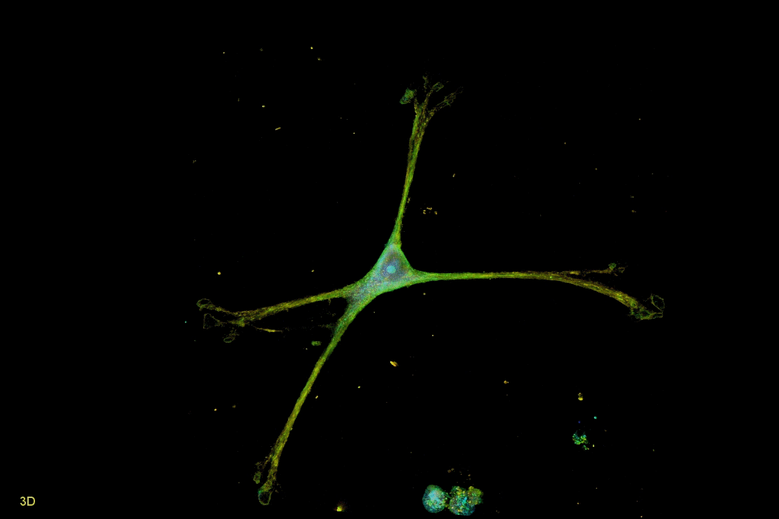 an astrocyte on the novel nanowire platform