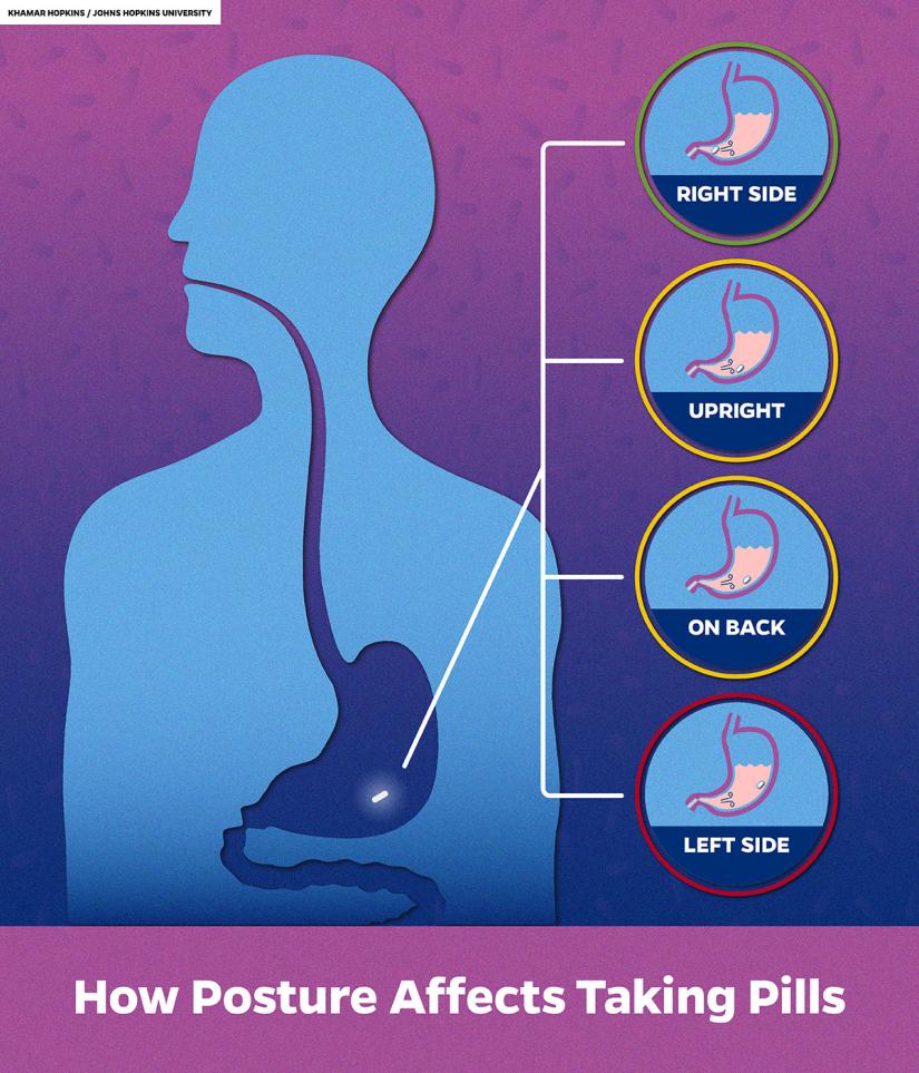 Graphic shows how various postures affect where pills land in the stomach