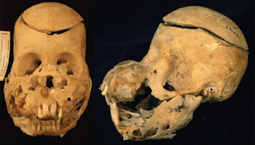 swollen skull of a young orangutan