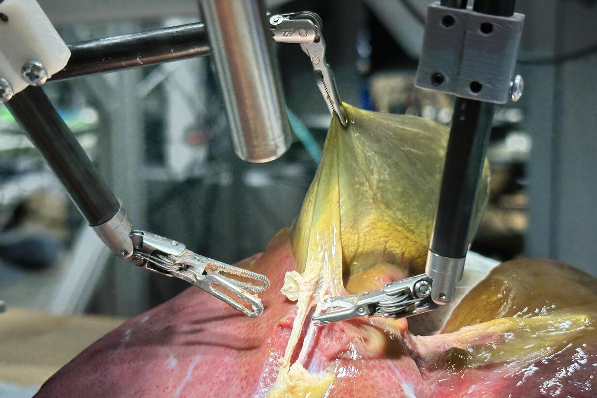 Robot performs first realistic surgery without human help