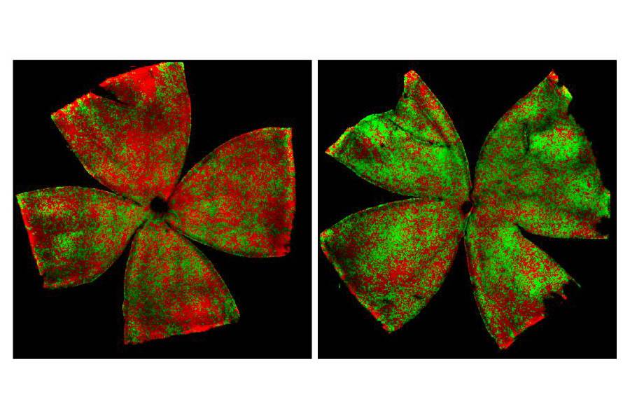 Colorcoding cells allows Hopkins researchers to find 'silent