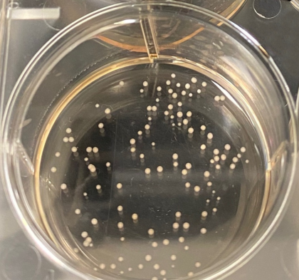 The organoids appear as tiny dots in a petri dish.