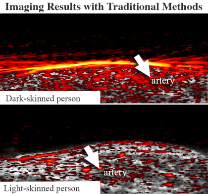 Imaging results with traditional methods