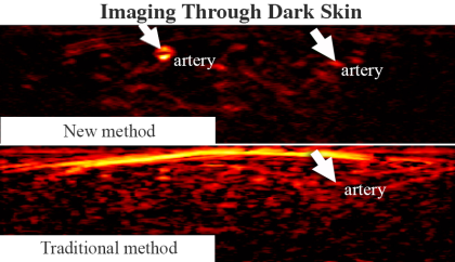 Imaging through dark skin