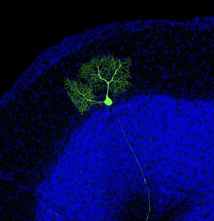 A single Purkinje cell in the mouse cerebellum