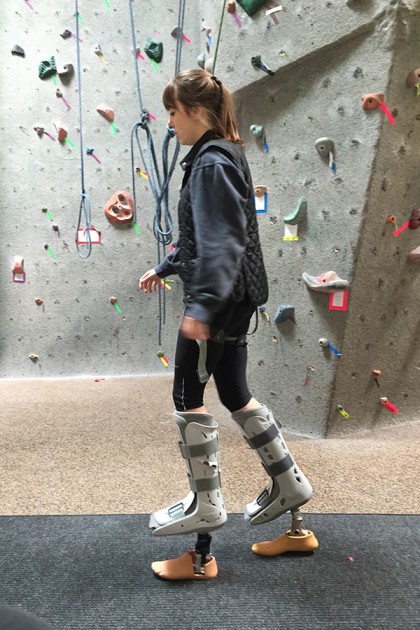 Prosthetic feet are attached to the soles of boots to perform the walk test.