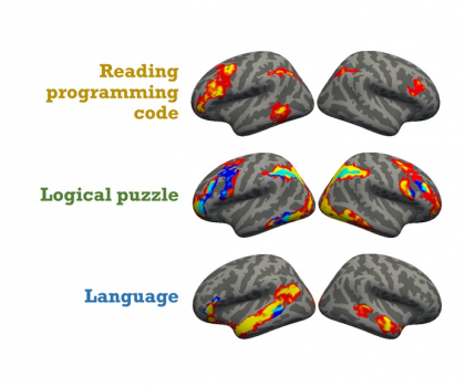 Graphic of brain activity