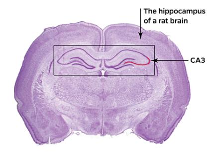 Hopkins neuroscientists pinpoint part of brain that taps into our