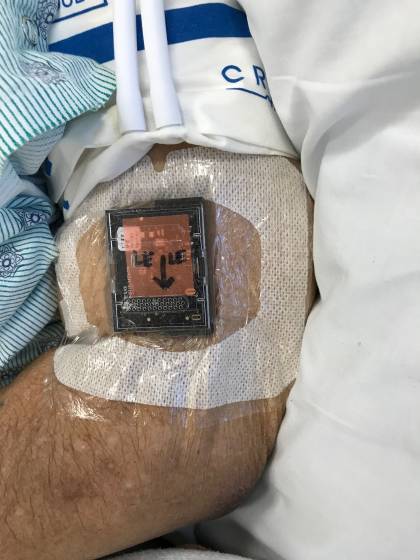 A sensor attached to a patient's left arm