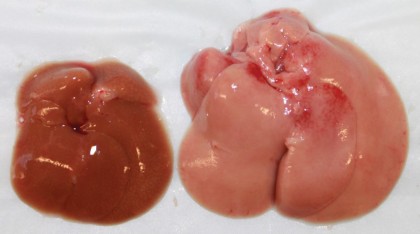 The livers of a normal mouse (left) and a mouse whose liver cells lack Cpt2 (right) after eating a high fat diet.