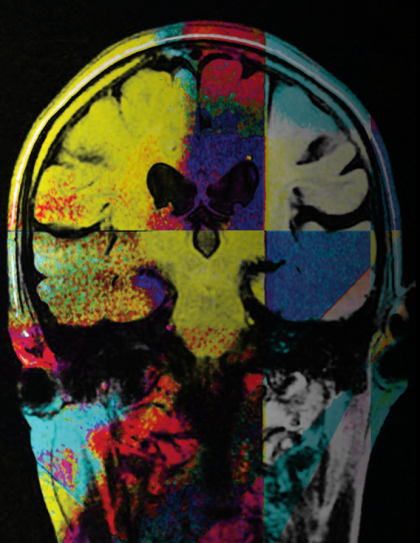 Multicolored image of an x-rayed brain