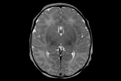 brain scan scans pediatric children database hub imaging researchers searchable hopkins building caption jhu edu