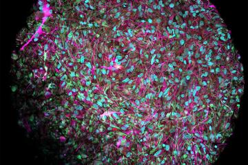 A close up of a brain organoid shows neurons in magenta, cell nuclei in blue, and other supporting cells in red and green. 