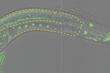 Roundworm embryo under a microscope