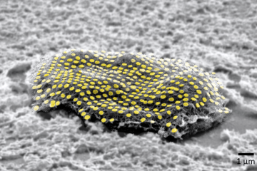 Black and white microscope image of a fibroblast cell with an array of gold nanodots highlighted in yellow.
