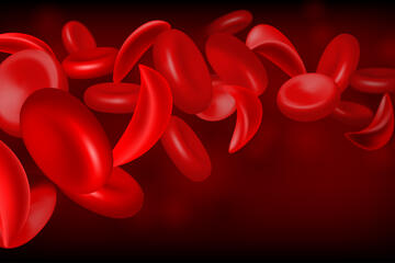 Rendering of sickle cells in the bloodstream; they are crescent-shaped instead of round 