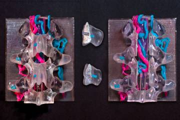 3D printed spine and veins