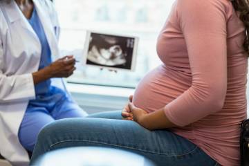 A pregnant woman looks at an ultrasound with a doctor
