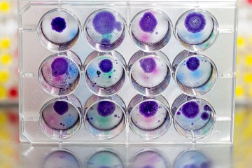 12 petri dishes contain purple cultures