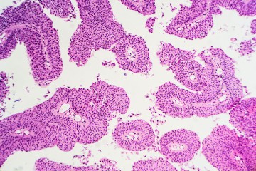 Microscopic view of pink clusters of cells