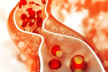 Drawing of cholesterol traveling through an artery