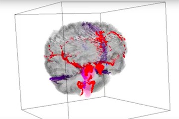 Colorful MRI brain scan image