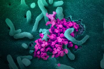 What is social distancing and how can it slow the spread of COVID-19?