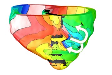 3-D depiction of the human heart color coded with half the heart in green and blue tones and half the heart in orange and red tones