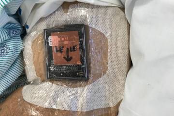 A sensor attached to a patient's left arm