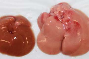 The livers of a normal mouse (left) and a mouse whose liver cells lack Cpt2 (right) after eating a high fat diet.