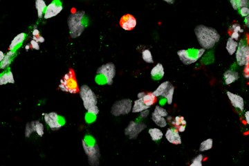 Magnified image of neural progenitor cells showing clusters of green and red dots