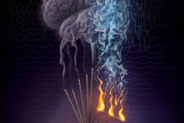 An illustration of neural fragility in the brain