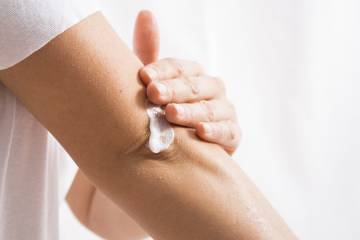 Woman applies white cream to her elbow