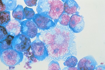 Blue and pink cells bunched together