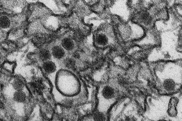 A transmission electron micrograph (TEM) of Zika virus