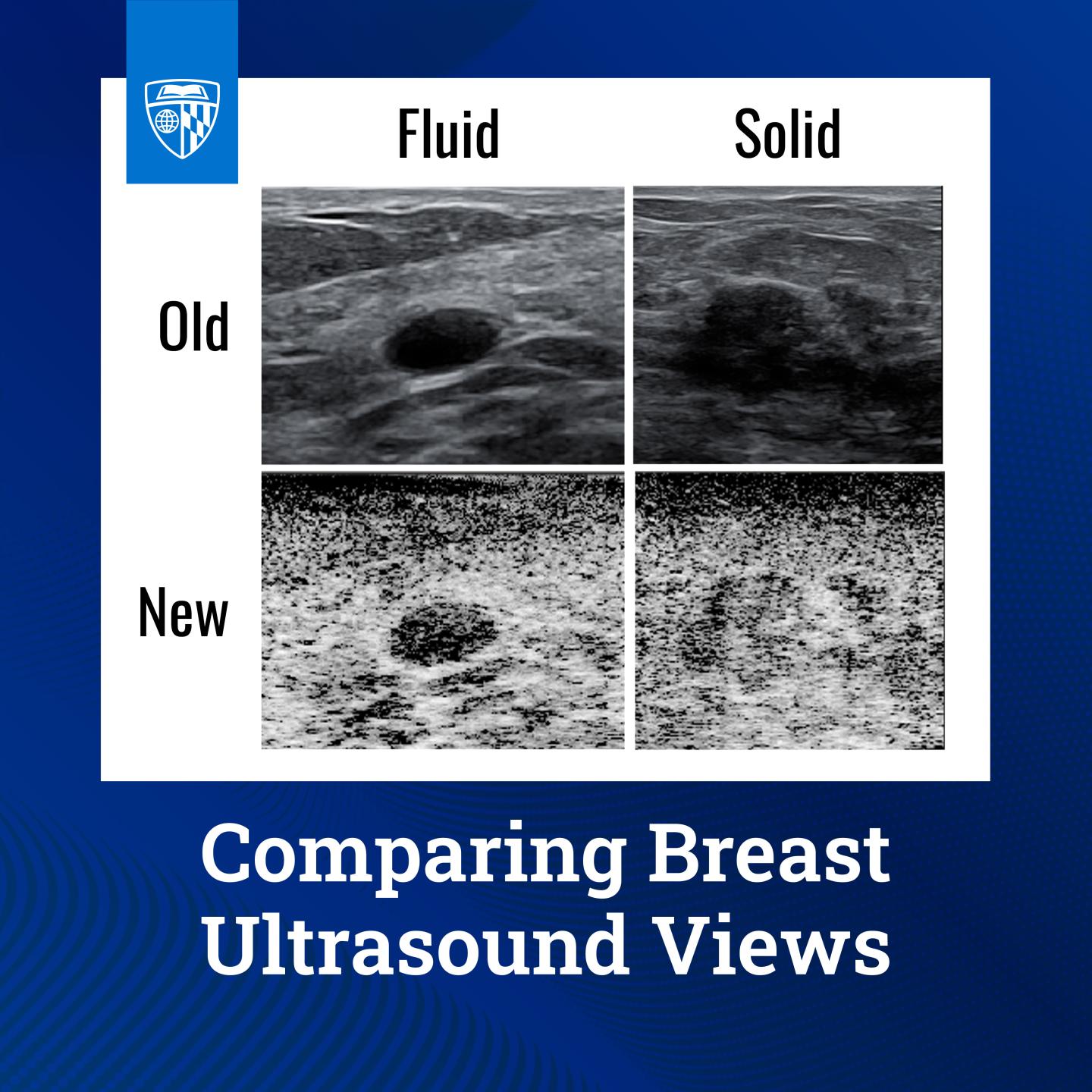 Conventional ultrasound of breast tissue compared to the new method