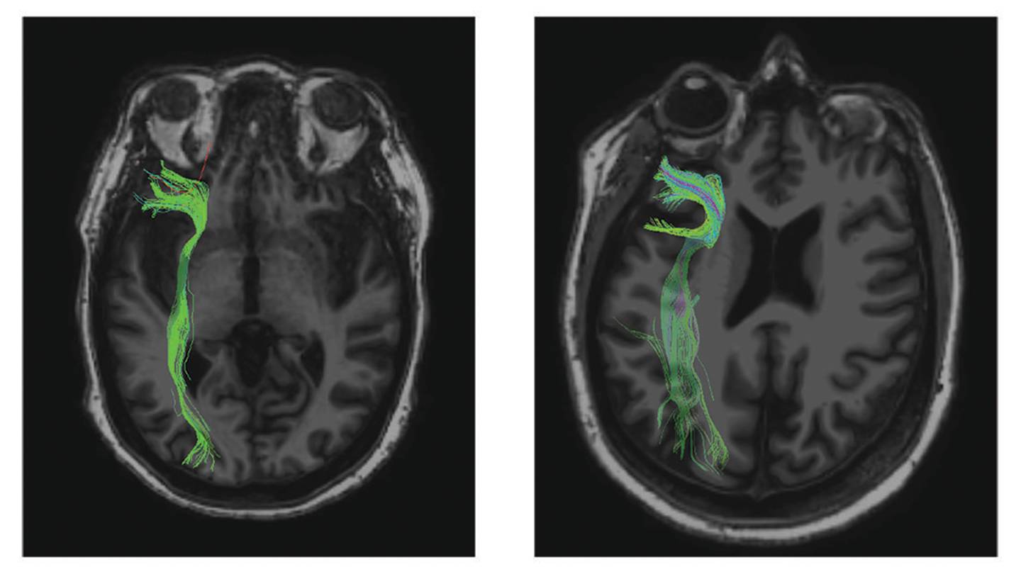 fMRI scans of two brains