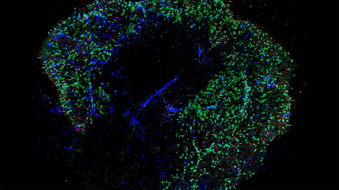 Colorized image of eye tissue