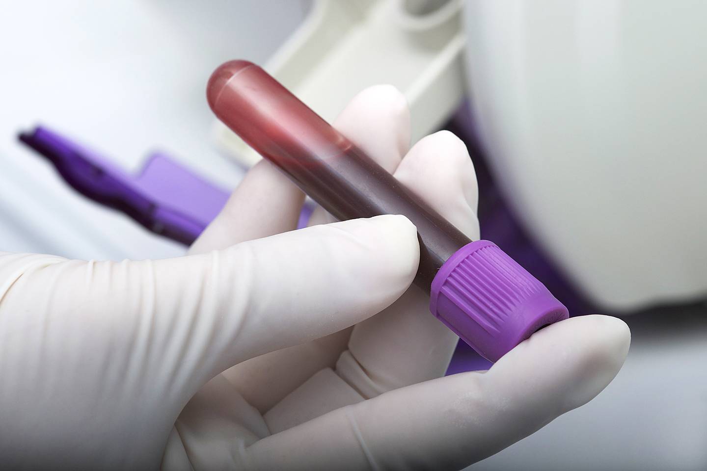 Can A Blood Test Detect Pancreas Problems