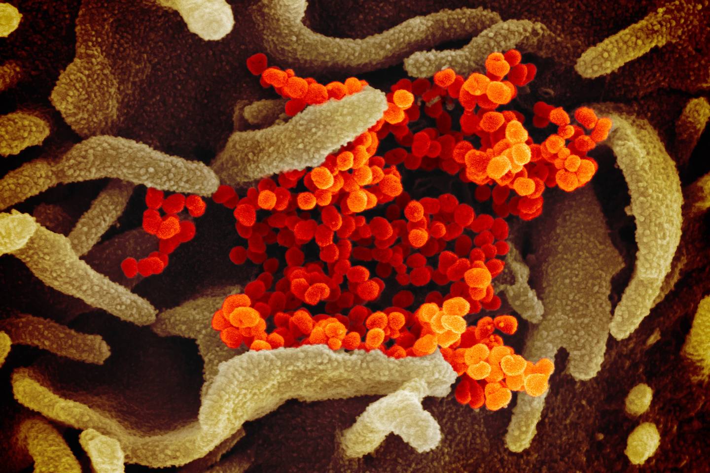 Resultado de imagen para síntomas de coronavirus