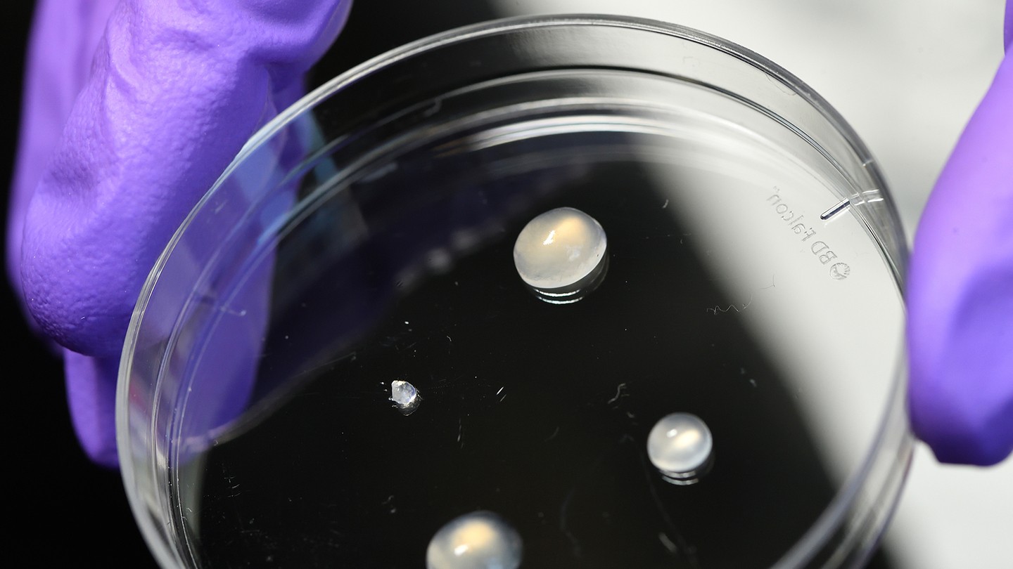 Hydrogels in a petri dish Hydrogels in a petri dish