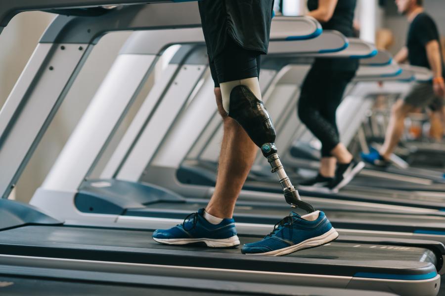 A person with a prosthetic leg walks on a treadmill