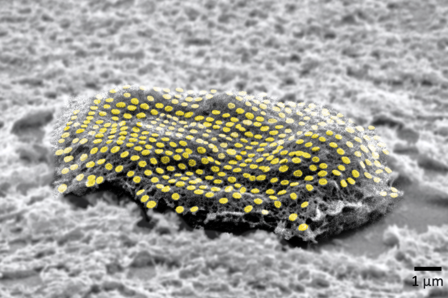Black and white microscope image of a fibroblast cell with an array of gold nanodots highlighted in yellow.