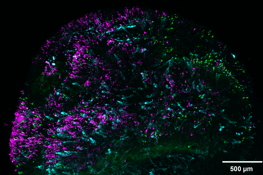 A microscopic view at 500 microns of two types of cells within a retina organid, showing blue cones in cyan and green/red cones in green.