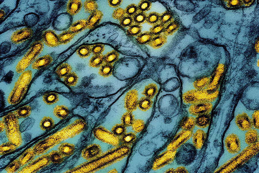 Colorized transmission electron micrograph of avian influenza A H5N1 virus particles (yellow), grown in Madin-Darby Canine Kidney (MDCK) epithelial cells (blue). Microscopy by CDC; repositioned and recolored by NIAID