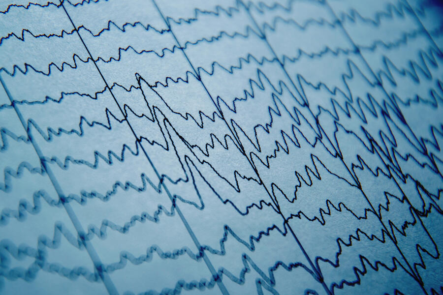 EEG wave in human brain, brain wave patterns on electroencephalogram