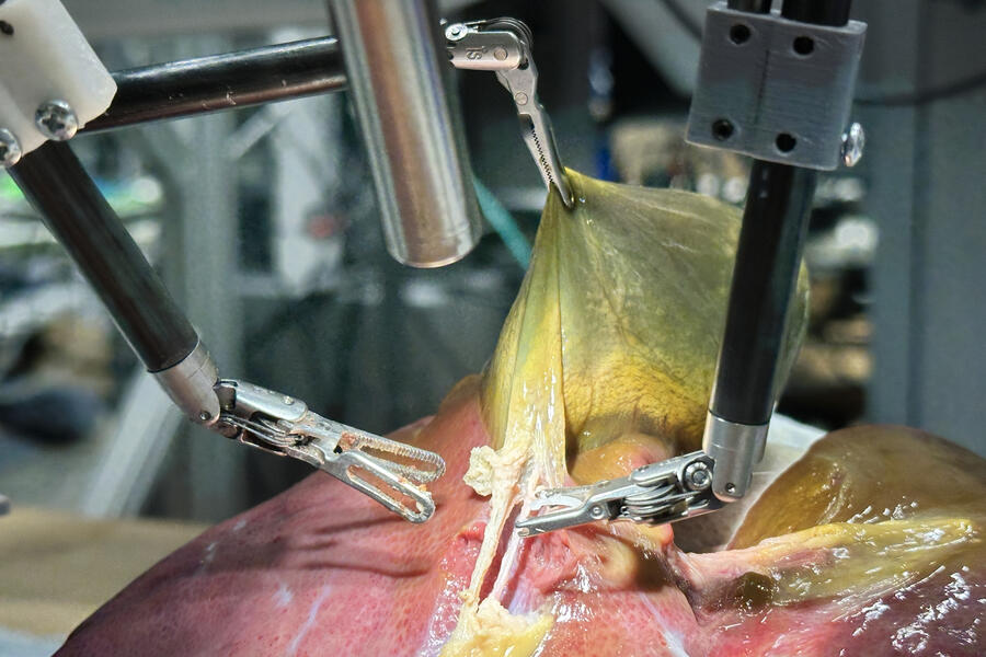The Surgical Robot Transformer-Hierarchy performing a gallbladder surgery